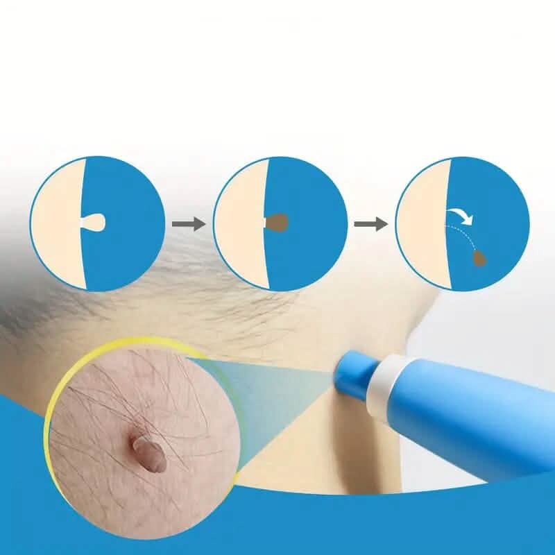 Advanced Auto Skin Tag Repair Kit